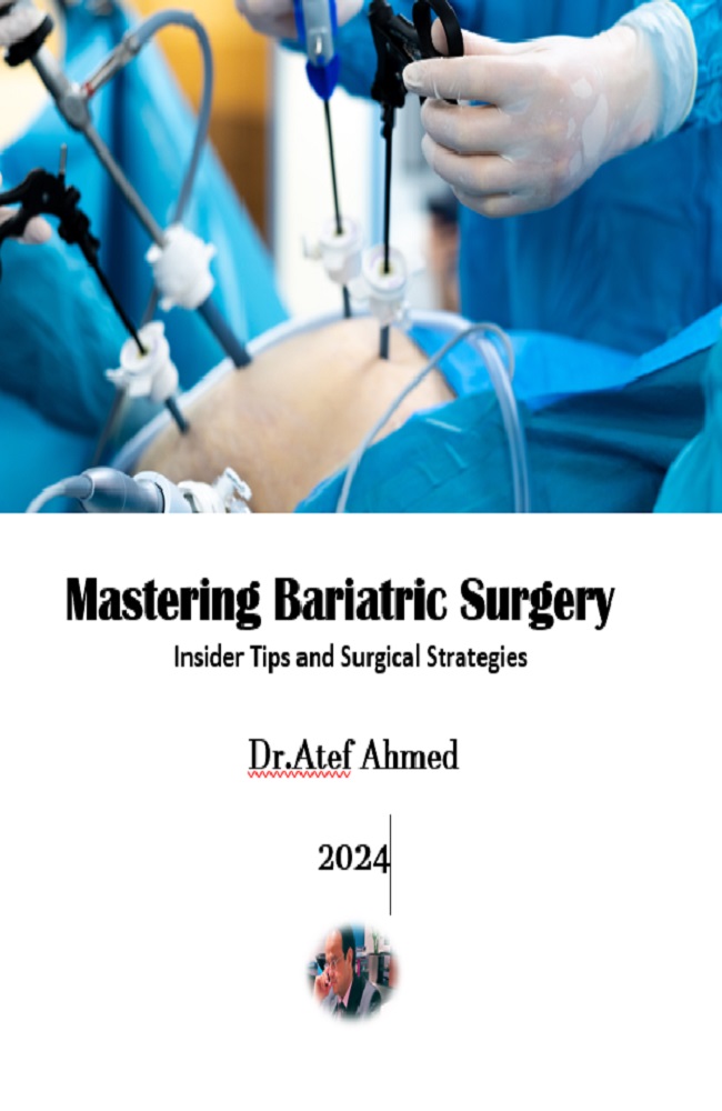 Mastering Bariatric Surgery Book Cover